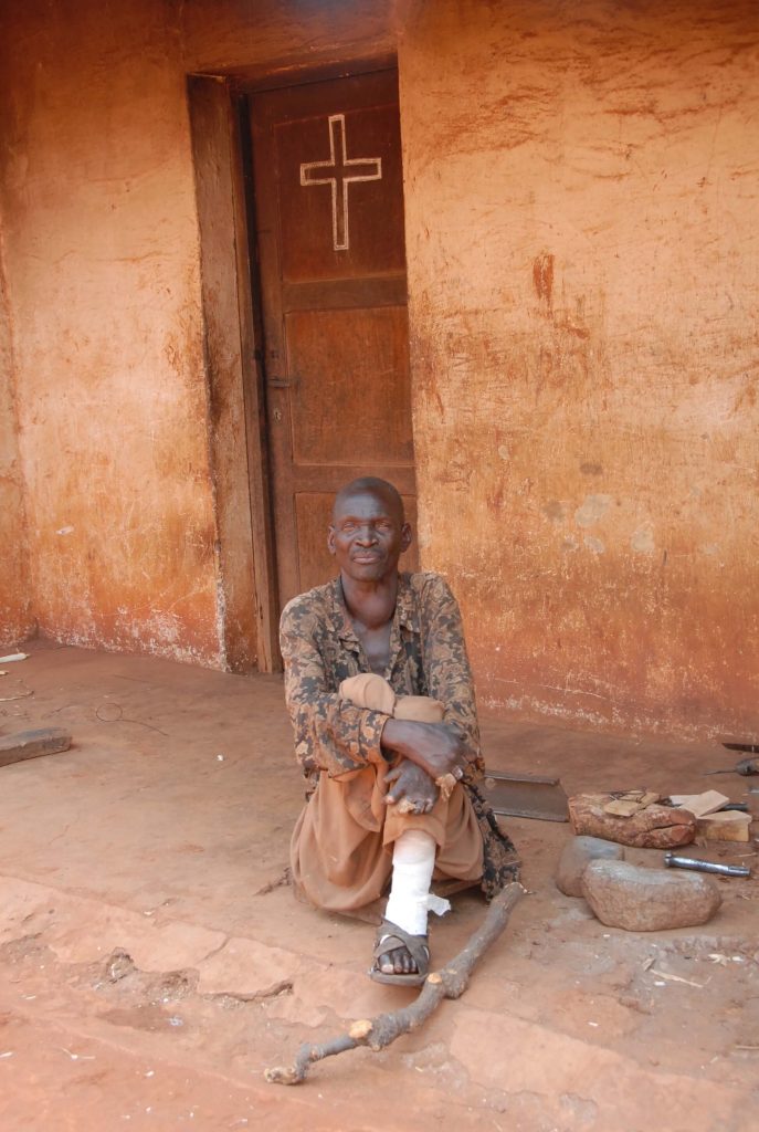 写真:施設の前で座る成人男性のハンセン病回復者