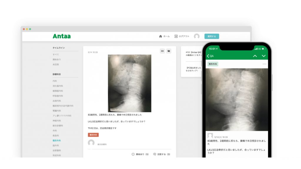 写真:「Antaa QA」の画面