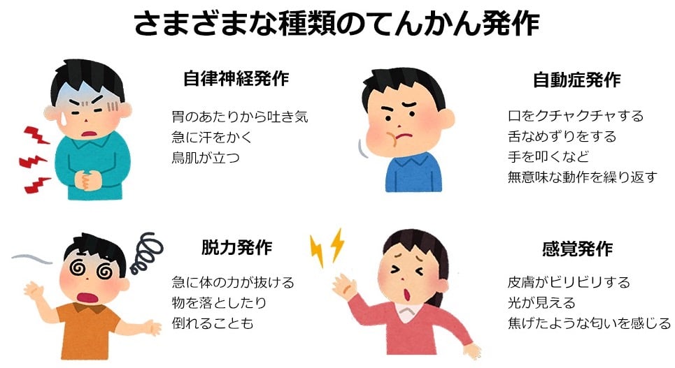 さまざまな種類のてんかん発作の例：

・自律神経発作
胃のあたりから吐き気
急に汗をかく
鳥肌が立つ

・自動症発作
口をクチャクチャする
舌なめずりをする
手を叩くなど無意味な動作を繰り返す

・脱力発作
急に体の力が抜ける
物を落としたり、倒れることも

・感覚発作
皮膚がビリビリする
光が見える
焦げたような匂いを感じる