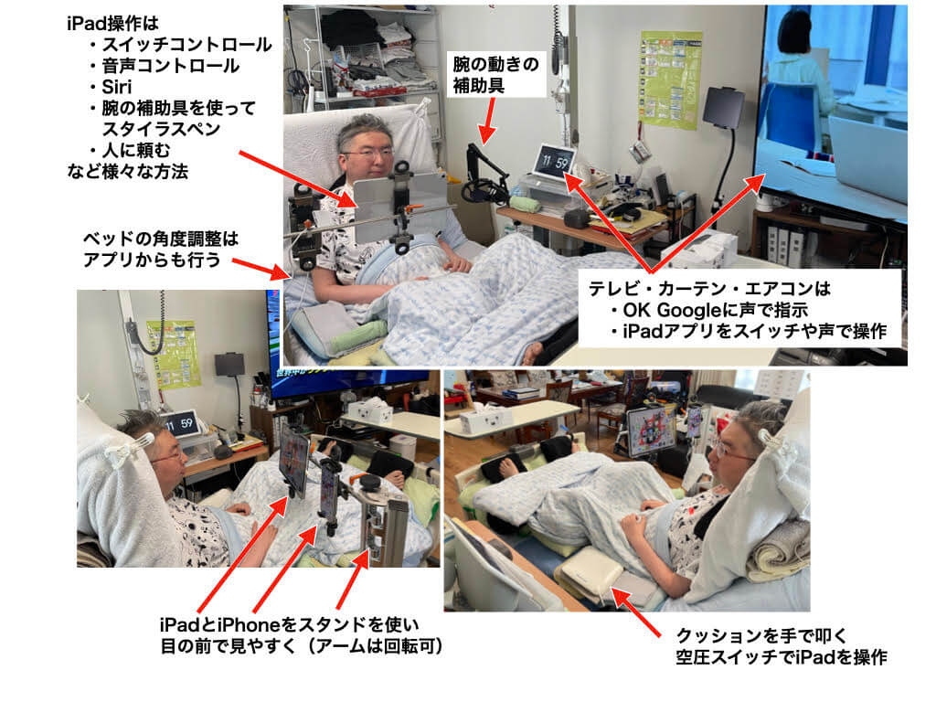 画像:高尾先生が実際に自宅で使用しているアクセシビリティ機器活用の様子。画像上部の写真:iPad操作は、スイッチコントロール、音声コントロール、Siri、腕の補助具を使ってスタイラスペン、人に頼む、など様々な方法がある。ベッドの角度調整はアプリからも行う。テレビやカーテン、エアコンは、「OK Google」に声で指示や、iPadアプリをスイッチや声で操作、の方法を用いている。ベッドサイドには、腕の動きの補助具も設置。 画面下部左側写真:iPadとiPhoneをスタンドを使い目の前で見やすく配置(スタンドのアームは回転可) 画面下部右側写真:クッションを手で叩く空圧スイッチでiPadを操作。
