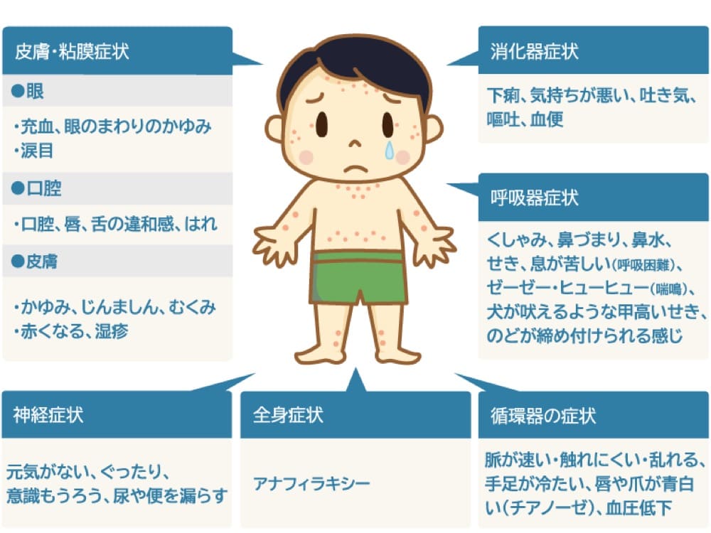 食物アレルギーの症状を説明するイラスト

皮膚・粘膜症状
目
・充血、目のまわりのかゆみ
・涙目
口腔
・口腔、唇、舌の違和感、はれ
皮膚
・かゆみ、じんましん、むくみ
・赤くなる、湿疹

消化器症状
下痢、気持ちが悪い、吐き気
嘔吐、血便

呼吸器症状
くしゃみ、鼻づまり、鼻水、せき、息が苦しい（呼吸困難）、ゼーゼー・ヒューヒュー（喘鳴）、犬が吠えるような甲高いせき、のどが締め付けられる感じ

神経症状
元気がない、ぐったり、意識もうろう、尿や便を漏らす

循環器の症状
脈が速い・触れにくい・乱れる、手足が冷たい、唇や爪が青白い（チアノーゼ）、血圧低下

全身症状
アナフィラキシー