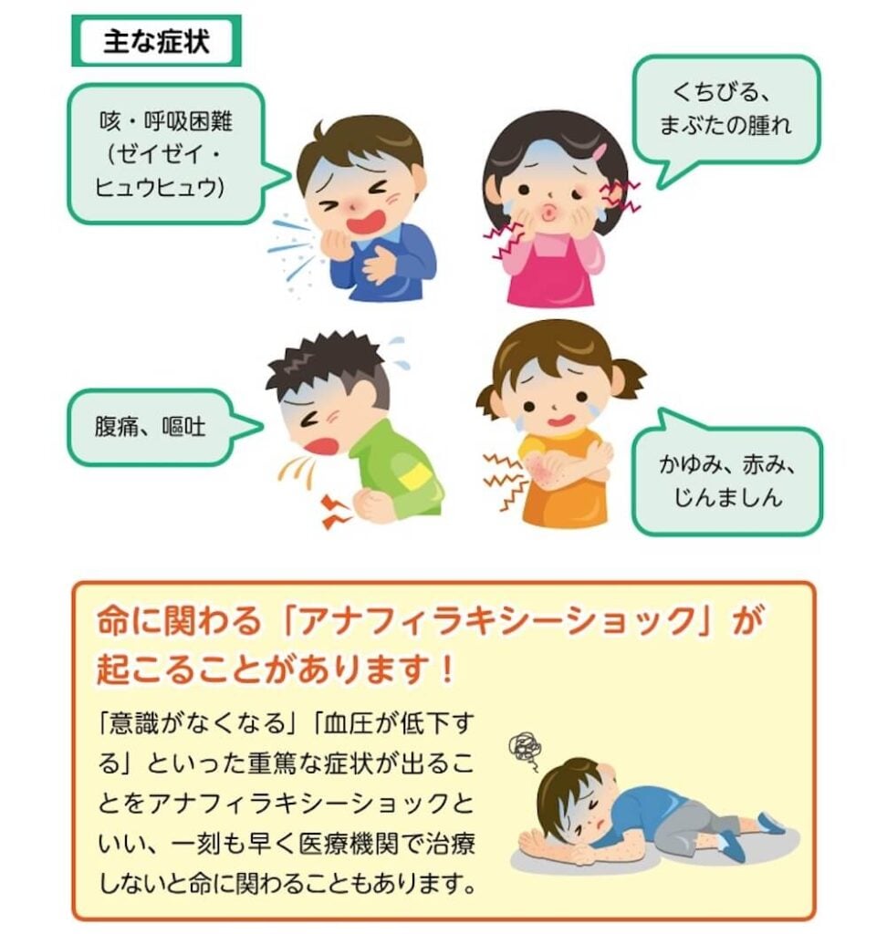 ・主な症状
咳・呼吸困難（ゼイゼイ・ヒュウヒュウ）
くちびる、まぶたの腫れ
腹痛、嘔吐
かゆみ、赤み、じんましん

・命に関わる 「アナフィラキシーショック」が起こることがあります!
「意識がなくなる」「血圧が低下する」といった重篤な症状が出ることをアナフィラキシーショックといい、一刻も早く医療機関で治療しないと命に関わることもあります